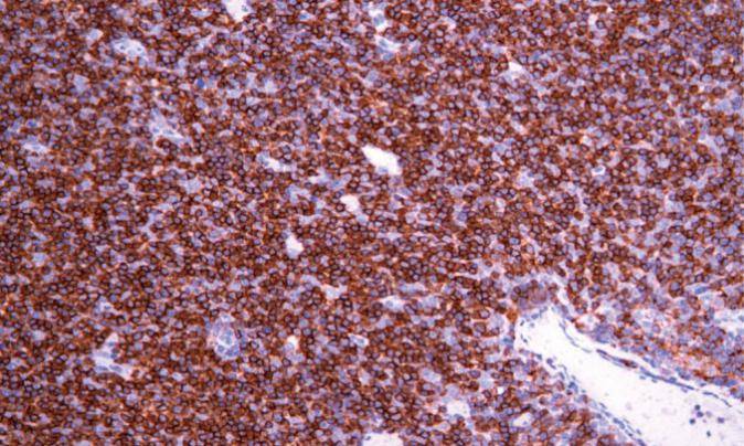 14 - Anti-CD4 antibody AD80285