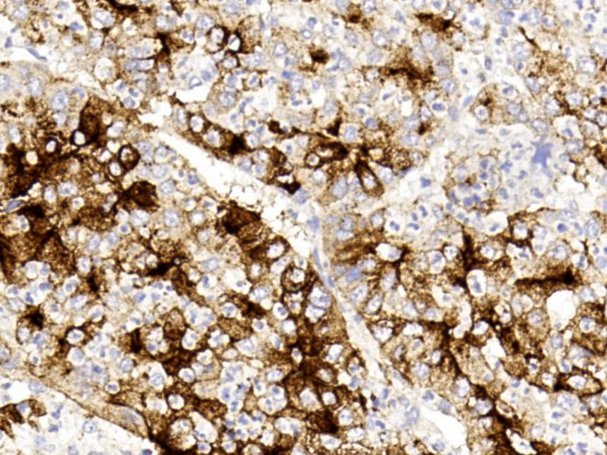 14 - Glypican 3 AD80291