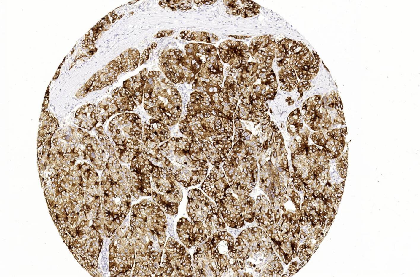 14 - Glypican 3 AD80291