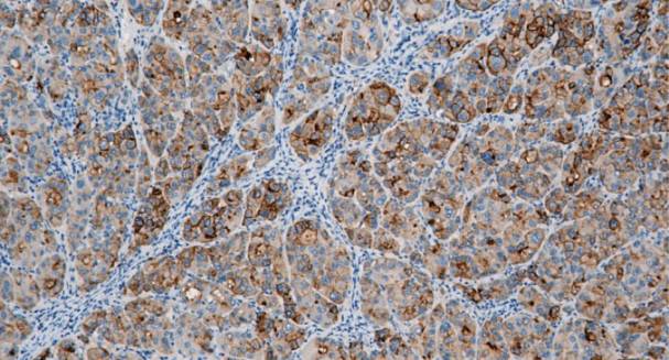 14 - Glypican 3 AD80291