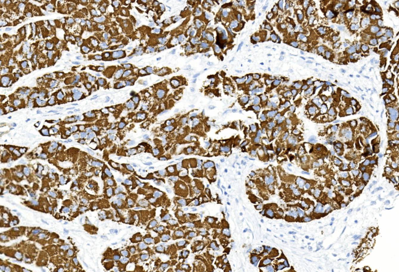 14 - Hepatocyte AD80292