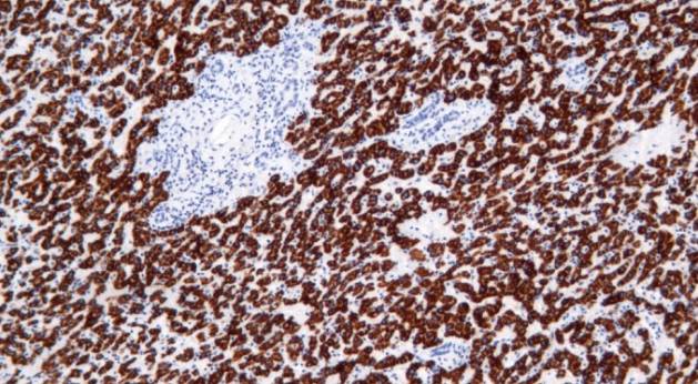14 - Hepatocyte AD80292