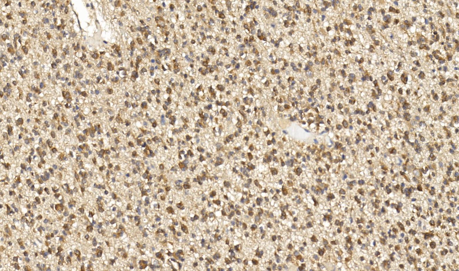 14 - IDH-1 AD80295