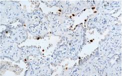 14 - Anti-MDM2 antibody  AD80300