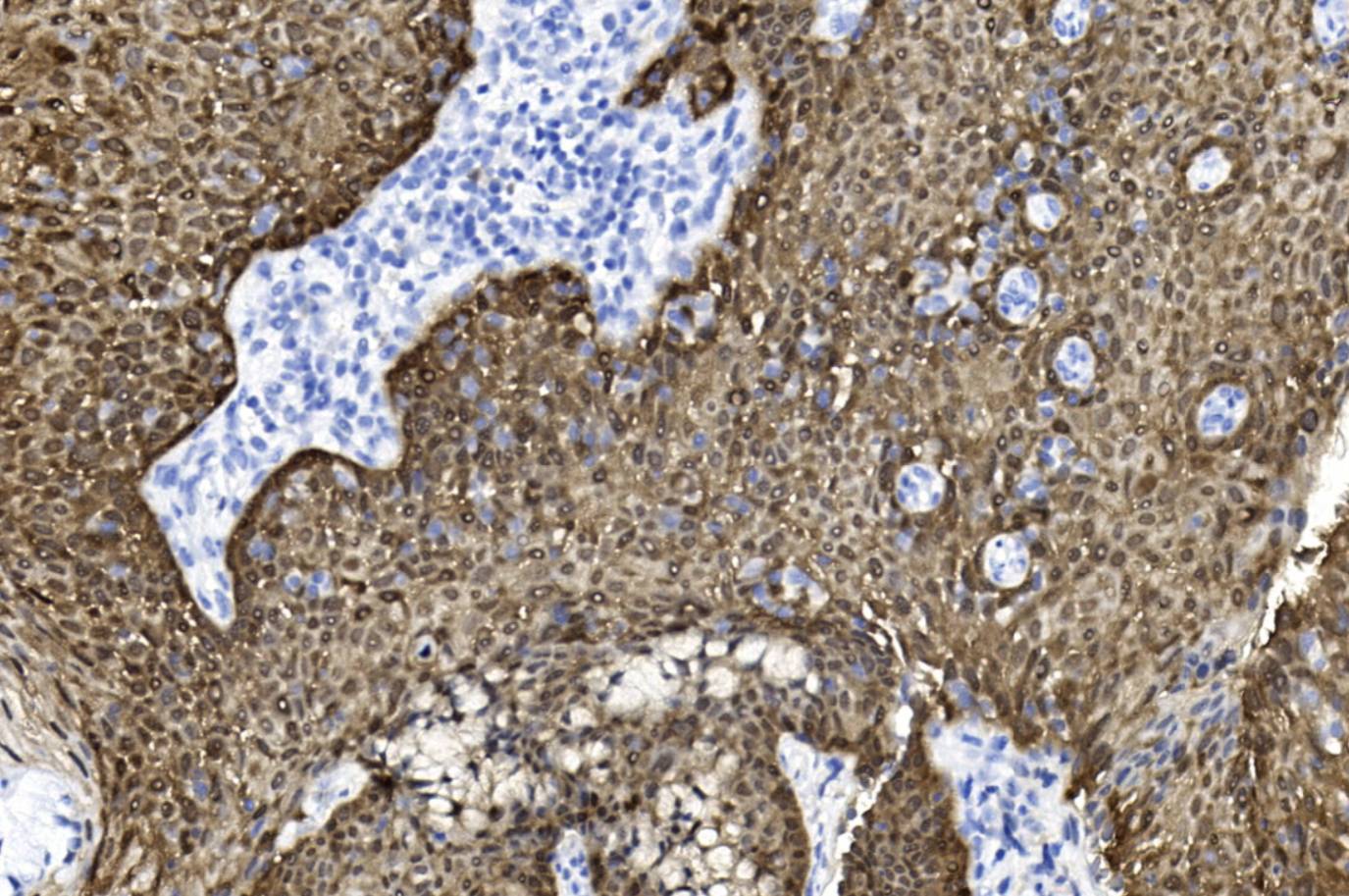 14 - p16 AD80303