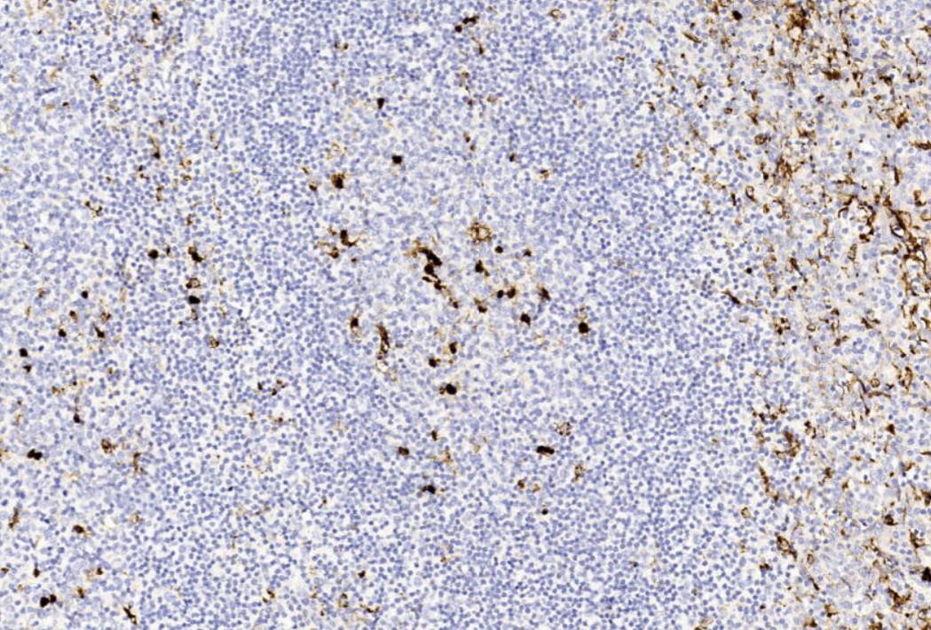 14 - Lysozyme AD80310