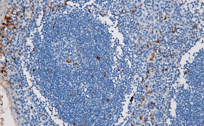 14 - Lysozyme AD80310