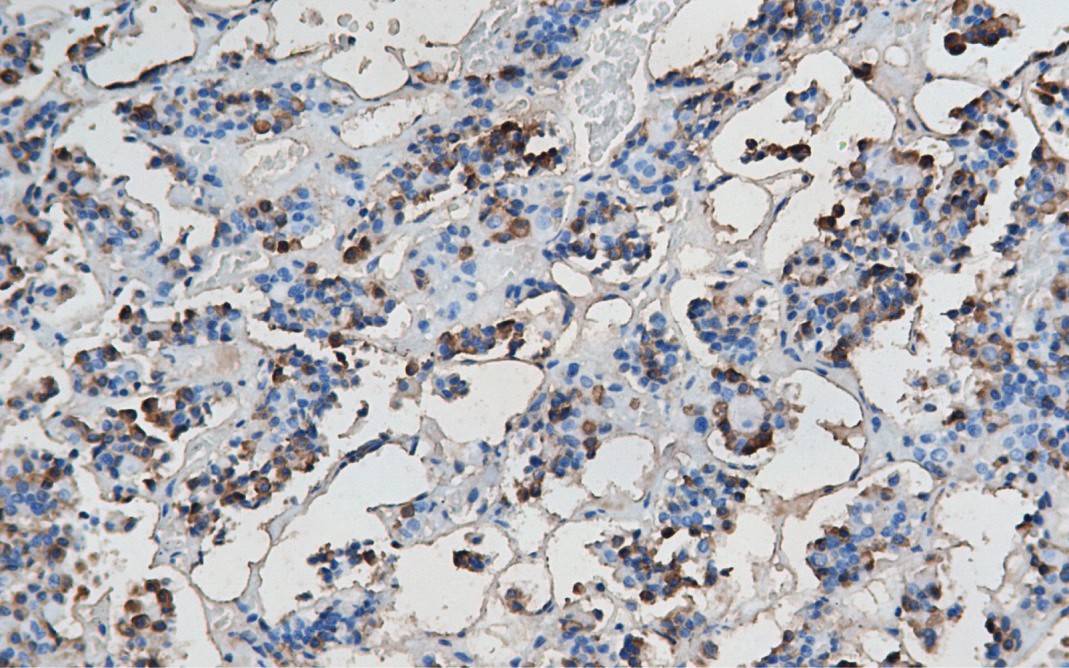 14 - HGH AD80322