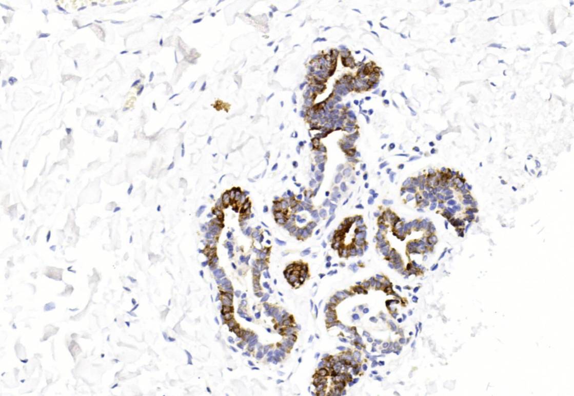14 - Mammaglobin AD80327