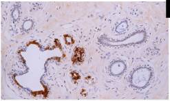 14 - Mammaglobin AD80327
