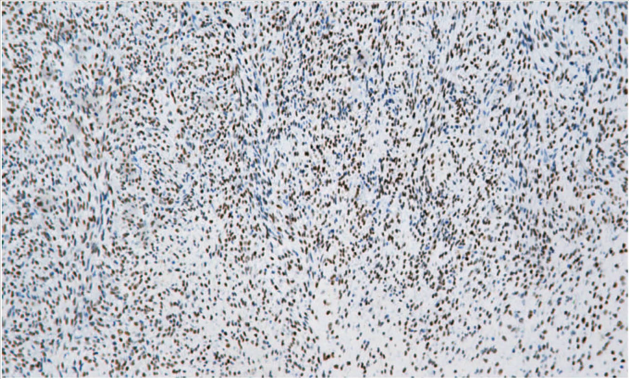14 - Anti -TLE1 antibody AD80334