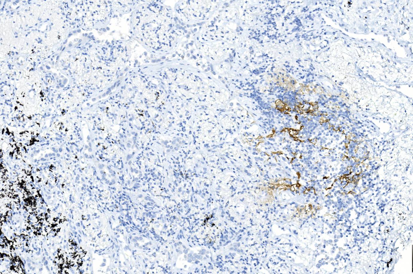 14 - CXCL-13 AD80339