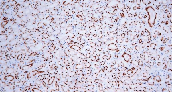 14 - HNF1-Beta AD80341
