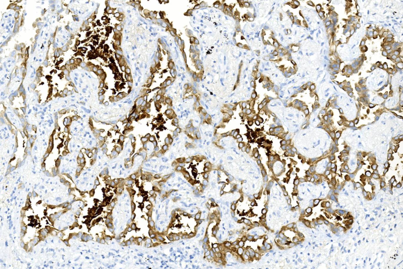 14 - CAM 5.2 AD80349