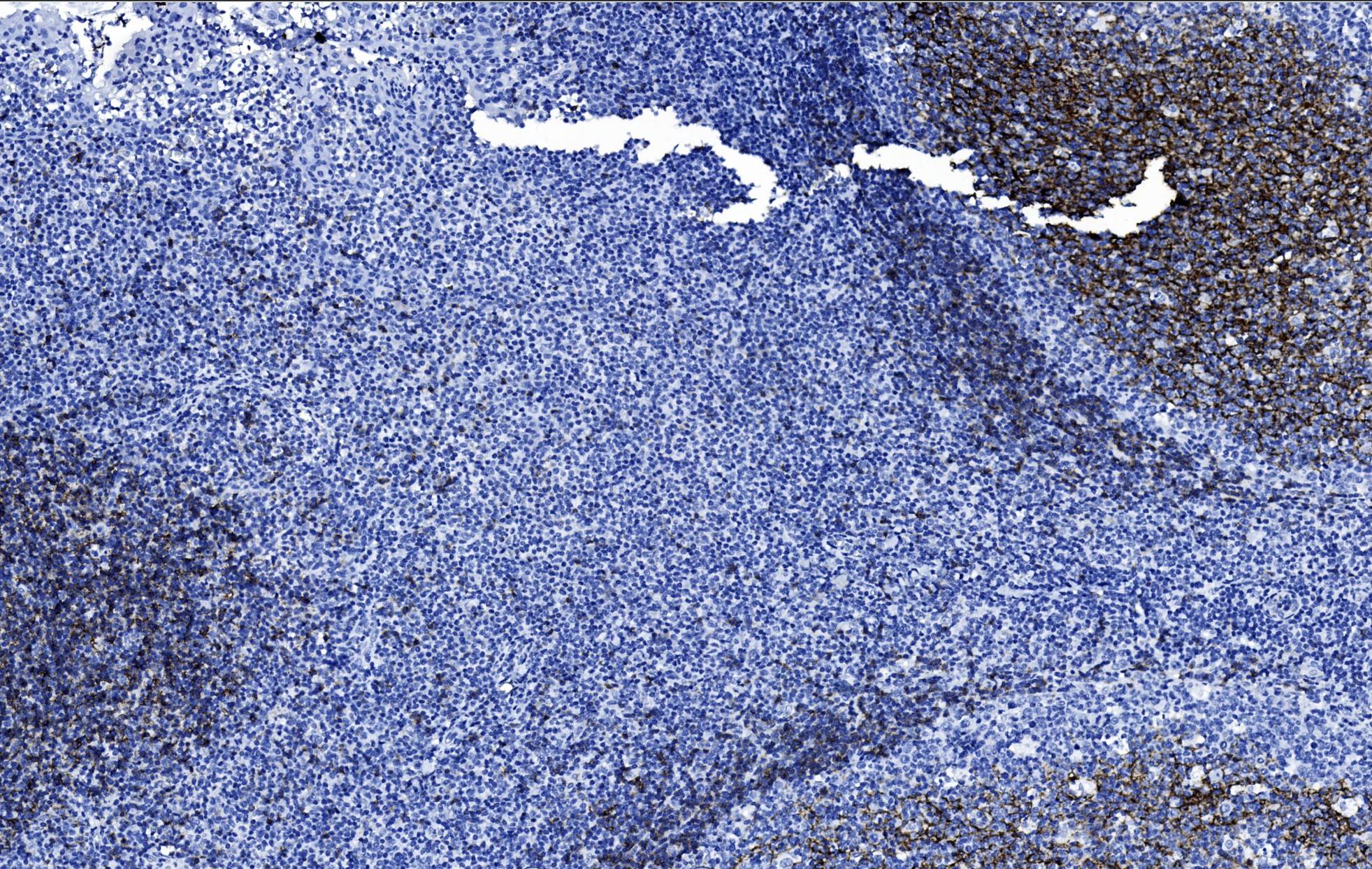14 - CD23 AD80351