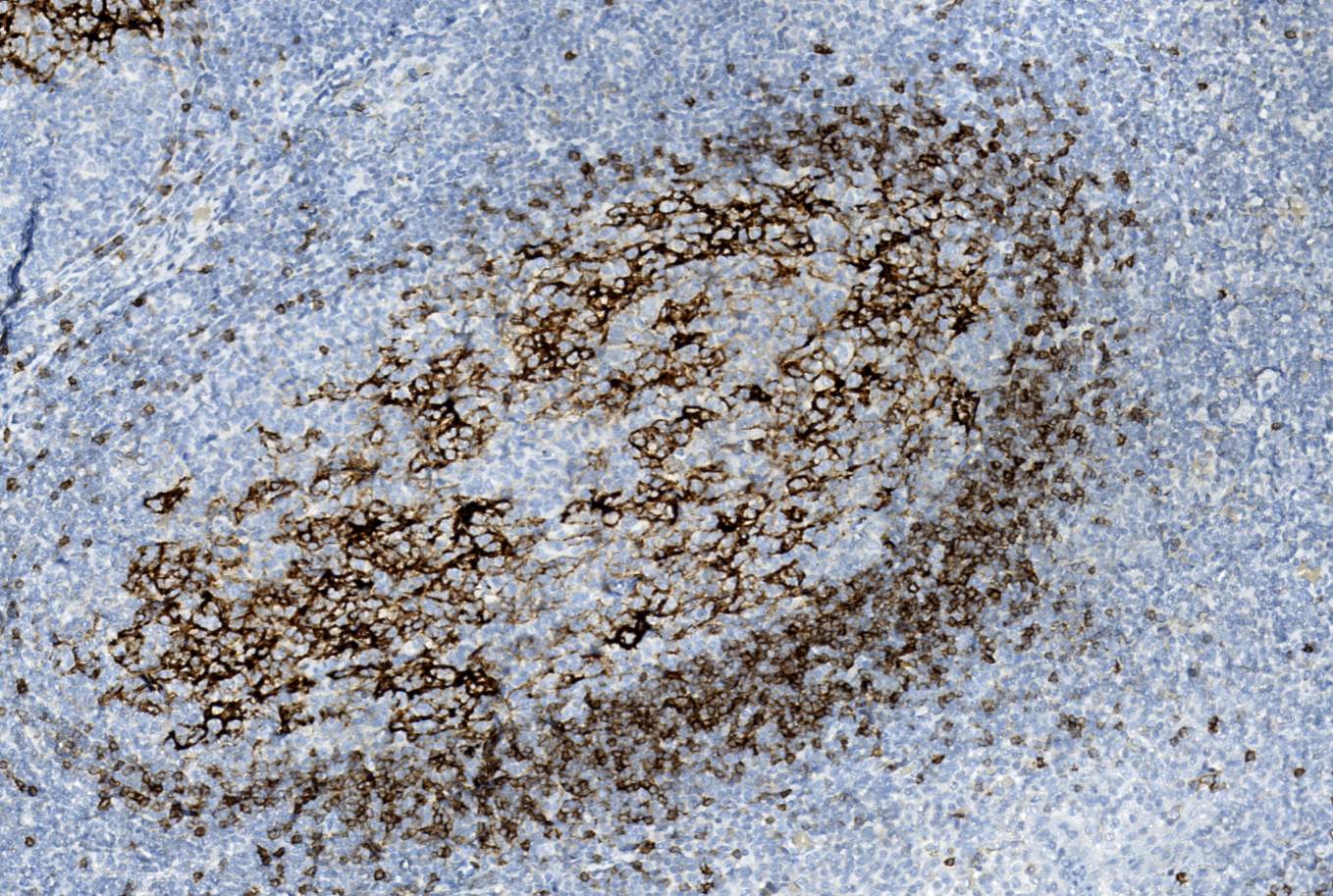 14 - CD23 AD80351