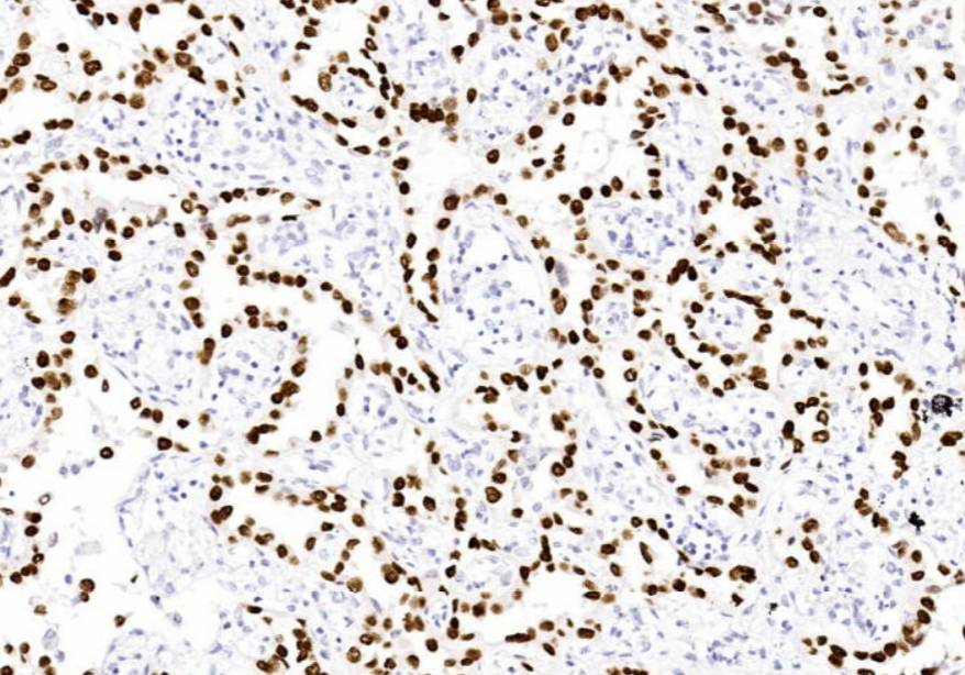 14 - TTF-1 AD80352