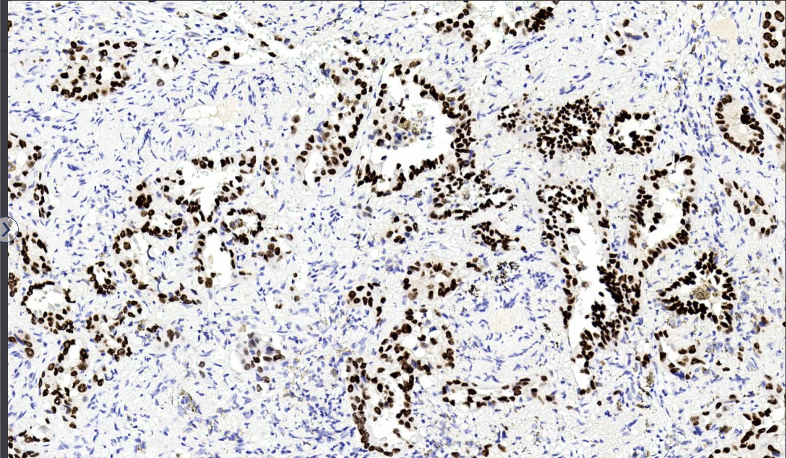 14 - TTF-1 AD80352