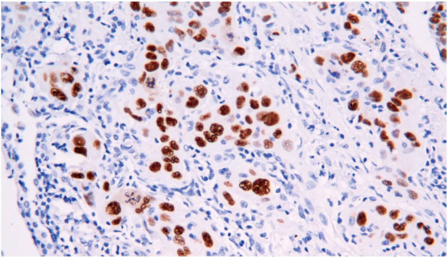 14 - TTF-1 AD80352