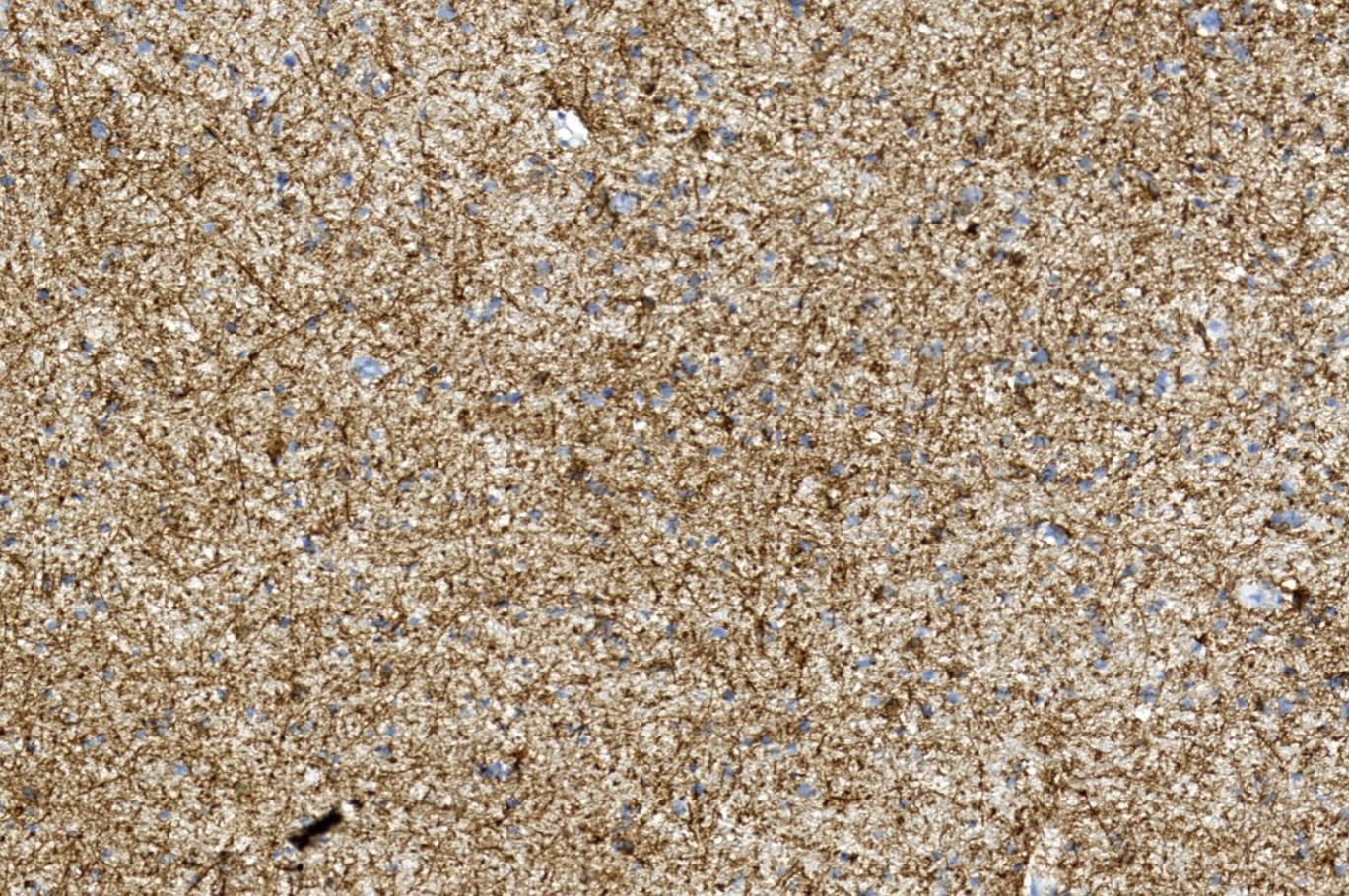 14 - GFAP AD80353