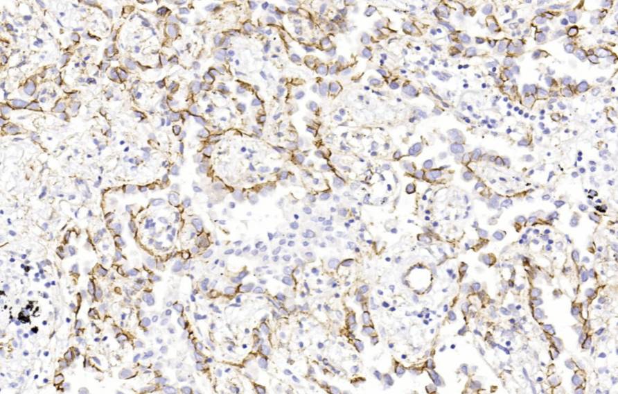 14 - Beta-catenin AD80414