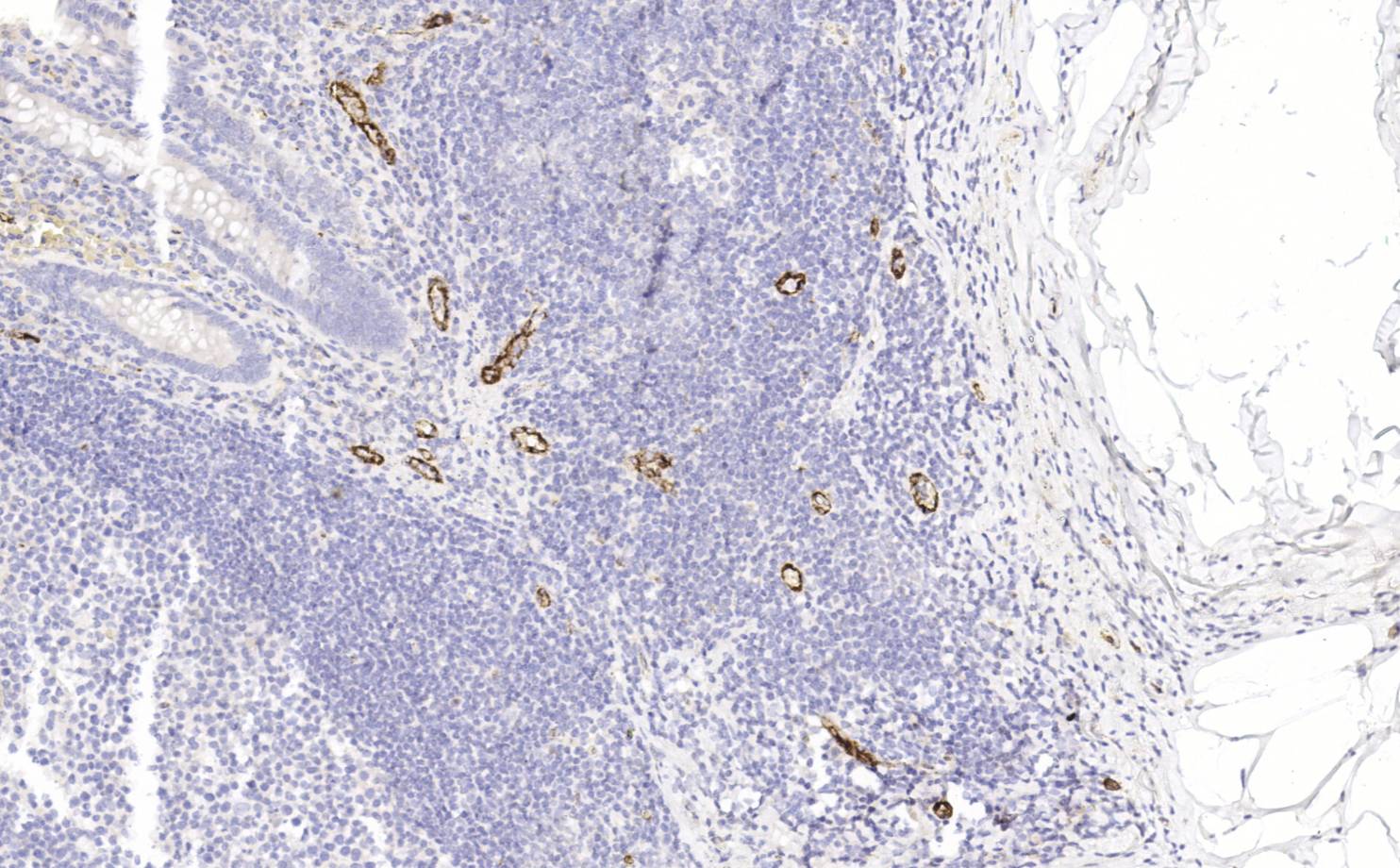 14 - Factor VIII AD80422