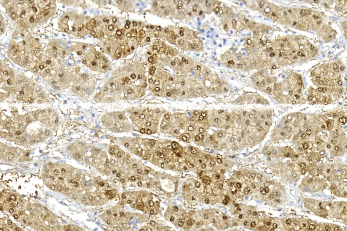 14 - Arginase-1 AD80436