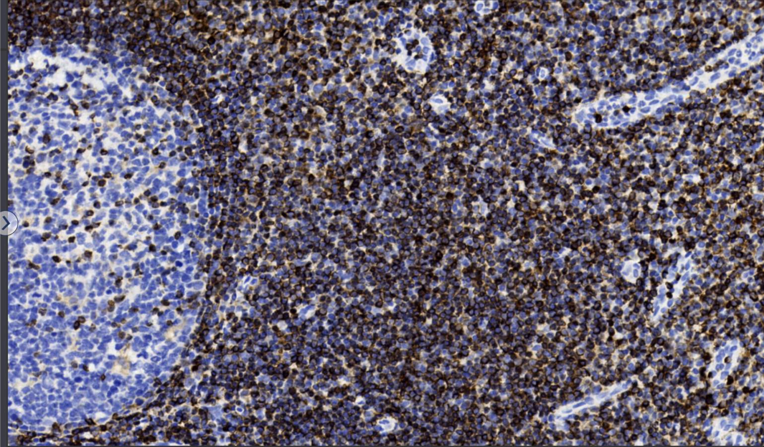 14 - bcl-2 AD80438