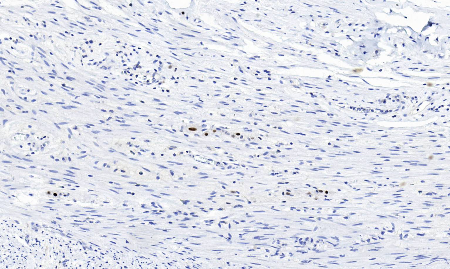 14 - PHOX2B AD80441