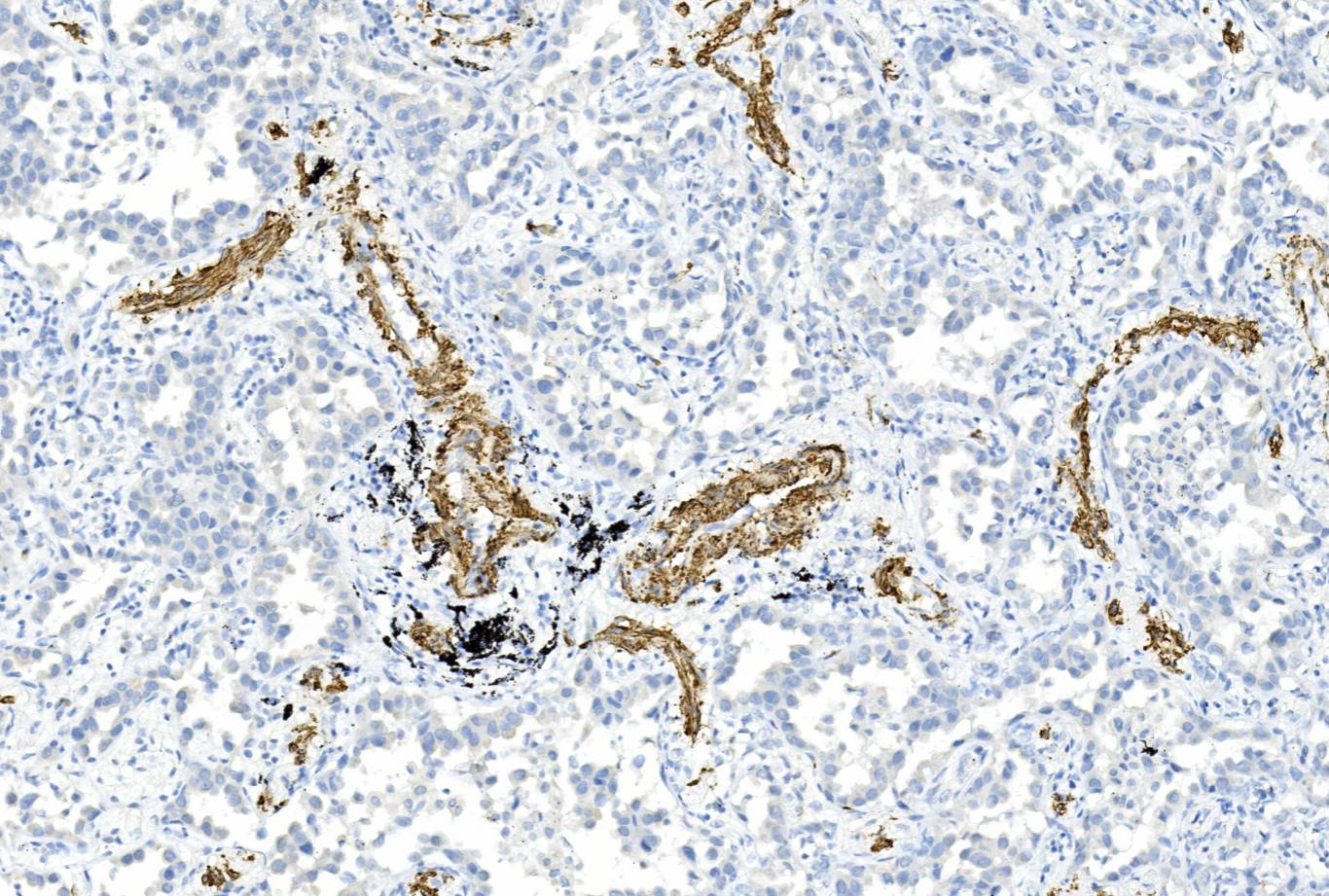 14 - Smooth Muscle Myosin AD80443