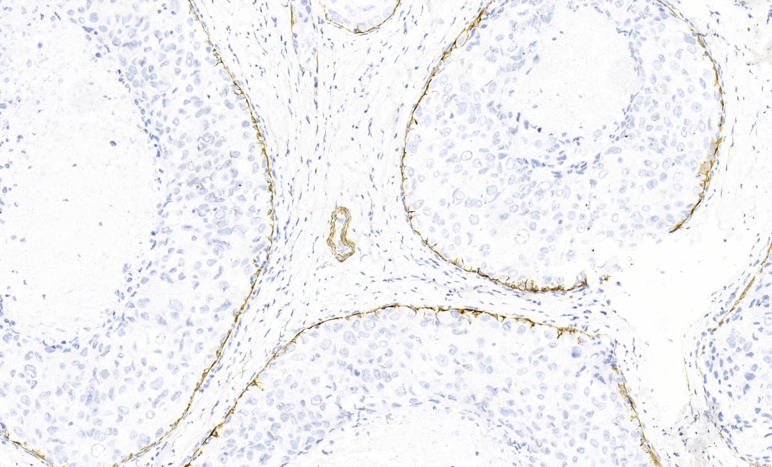 14 - Smooth Muscle Myosin AD80443
