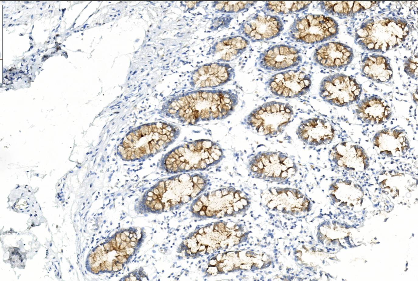 14 - Anti-MUC-4 antibody AD80444