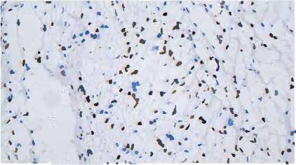14 - Oligo-2 AD80447