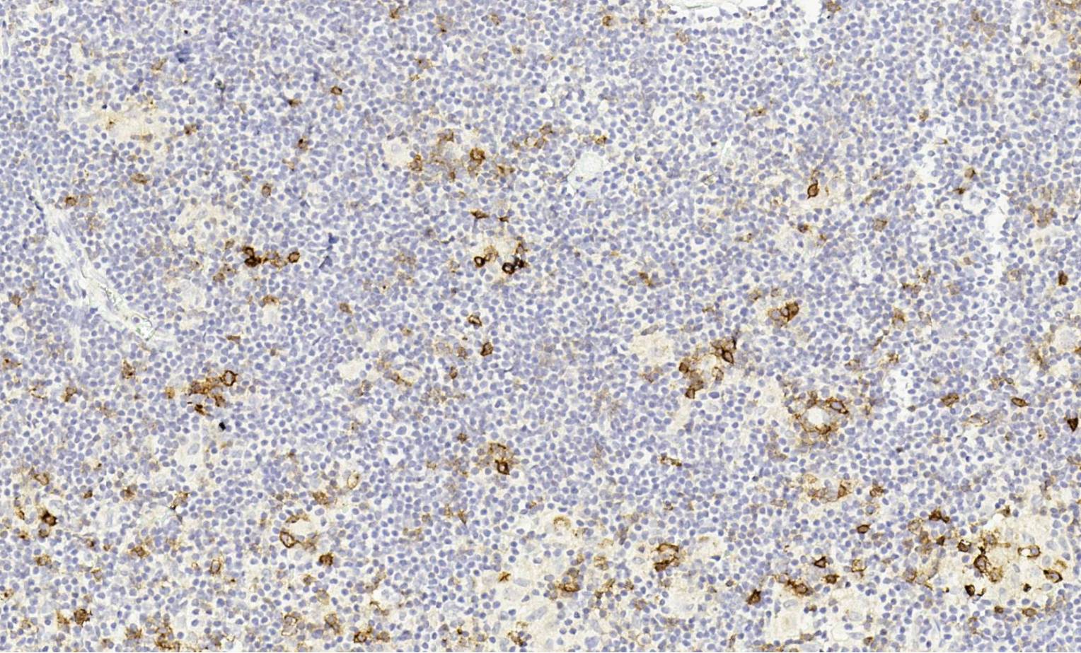 14 - OX40 AD80449