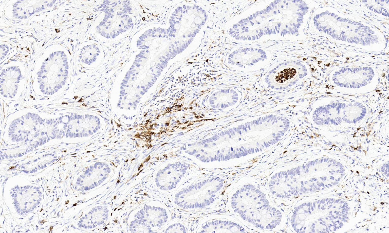 14 - CD11b AD80462