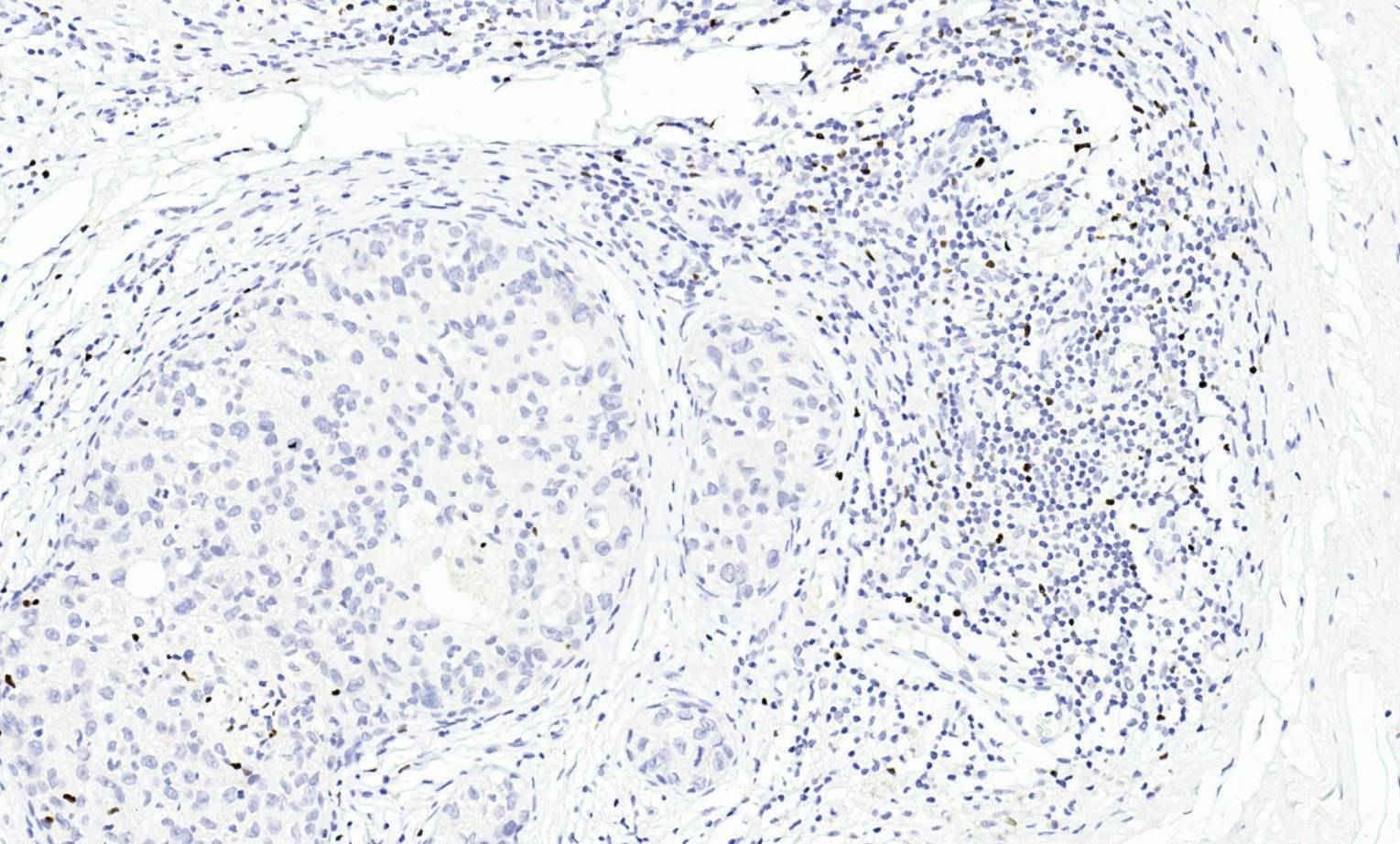 14 - Anti-FoxP3 antibody AD80464