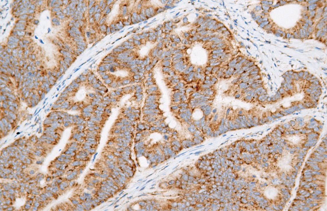 14 - HGAL AD80470