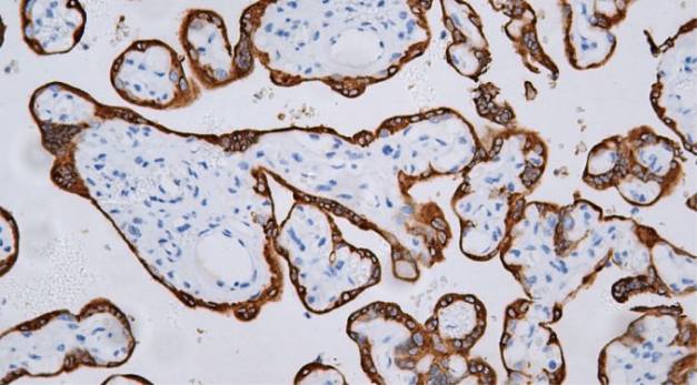 14 - Human Placental Lactogen AD80477