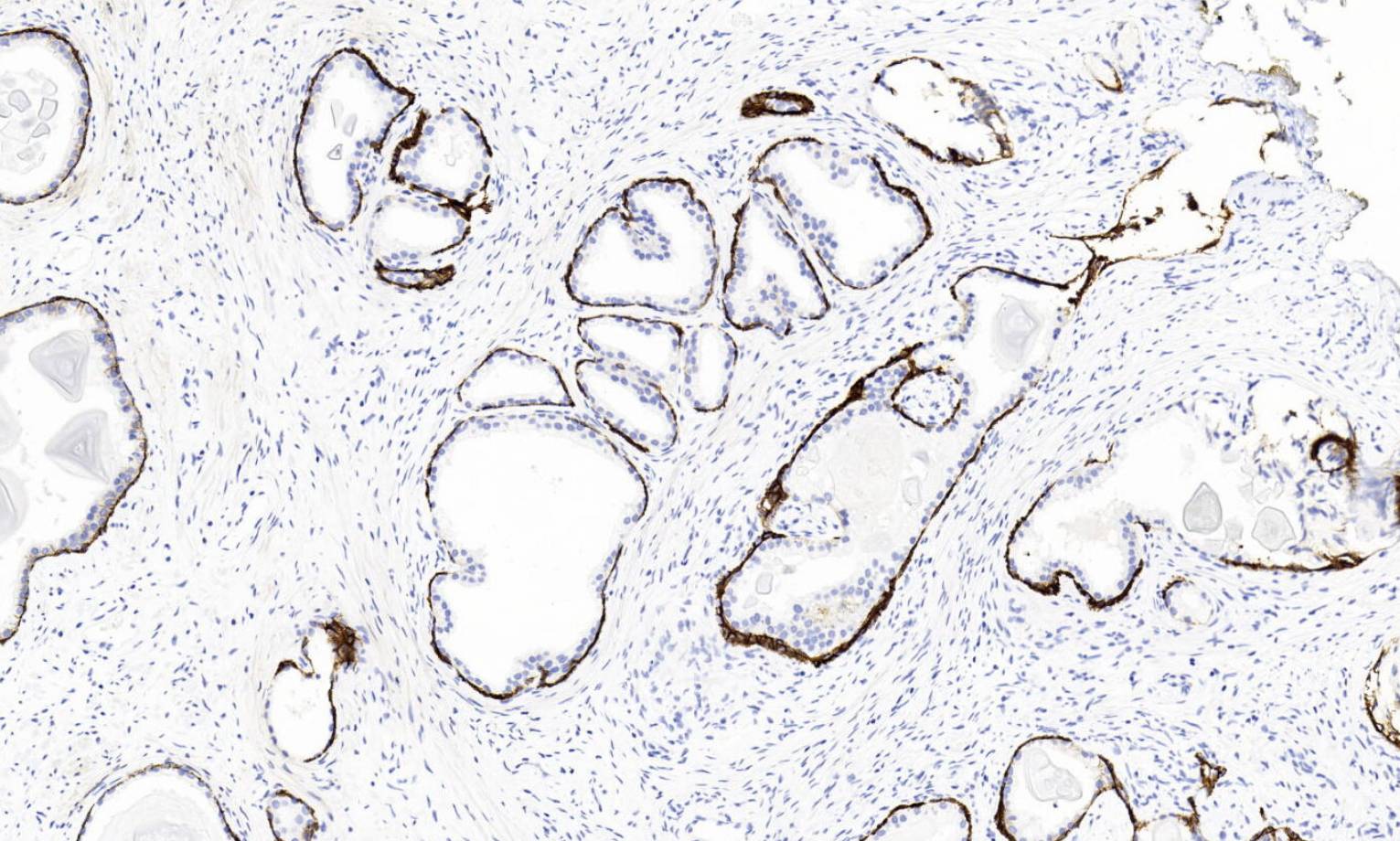 14 - CD44v6 AD80487