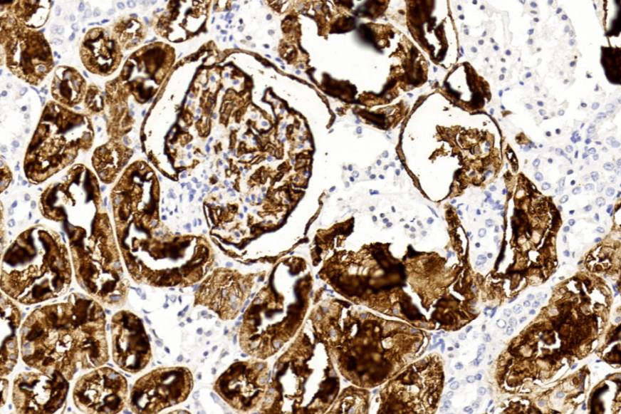 14 - CD10 AD80489