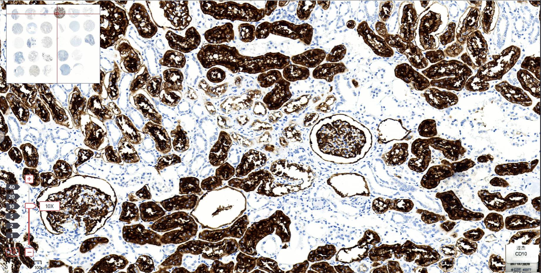 14 - CD10 AD80489