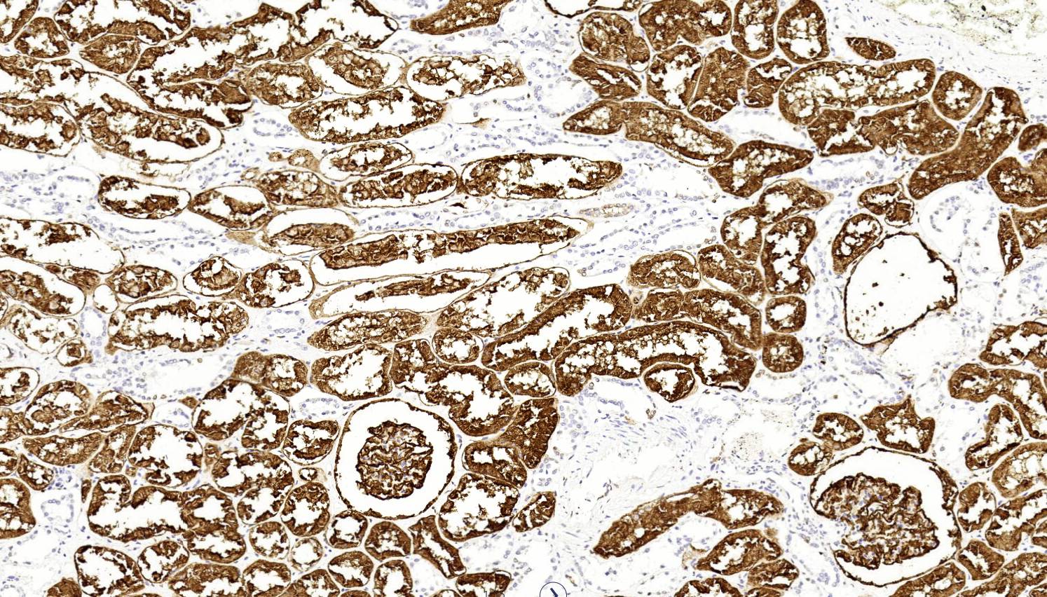 14 - CD10 AD80489