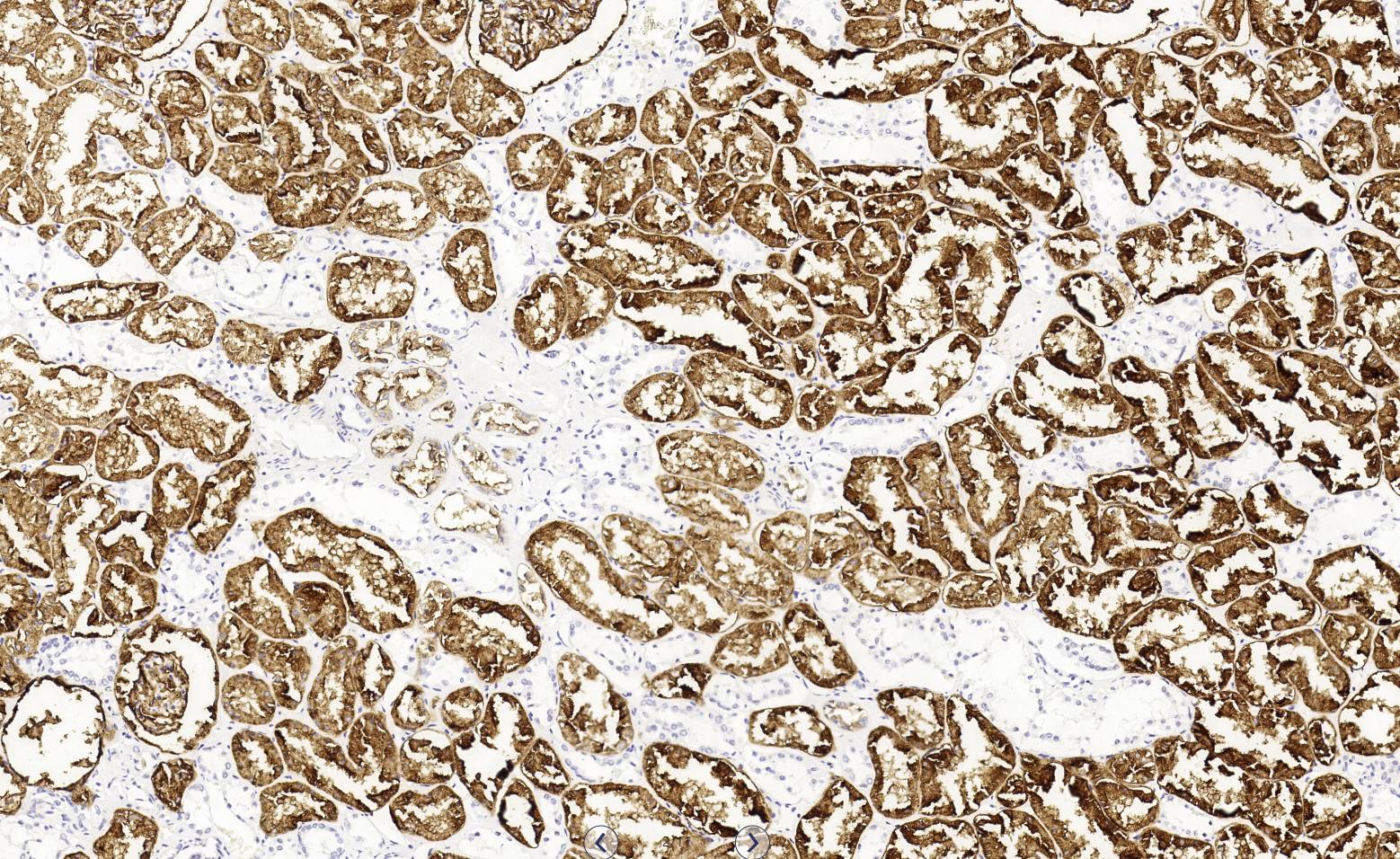 14 - CD10 AD80489