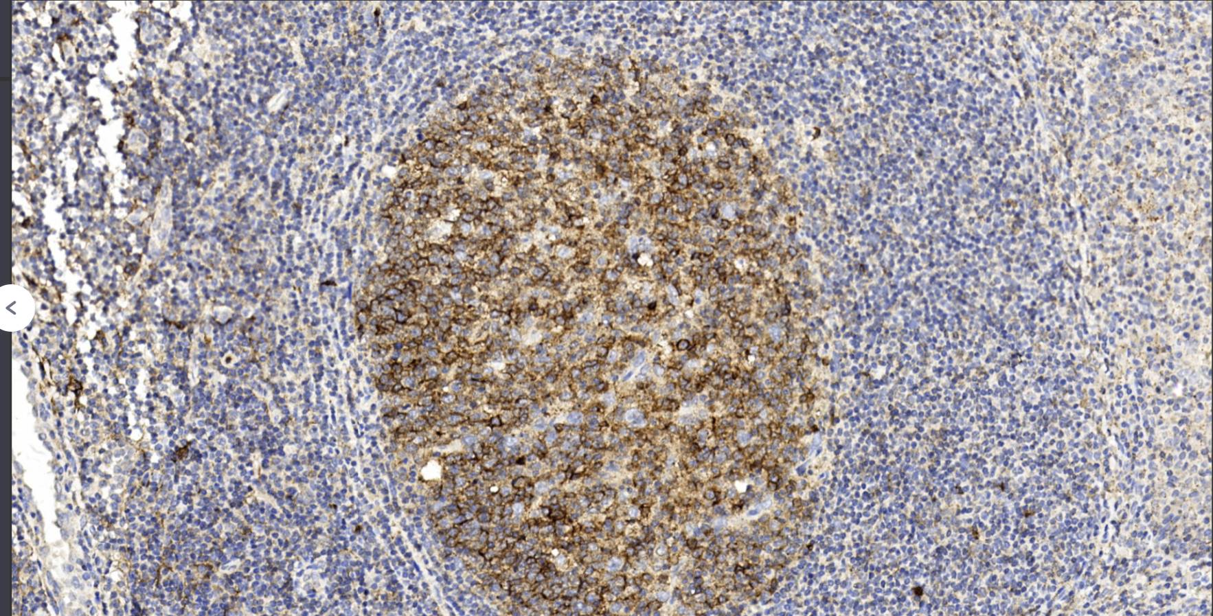 14 - CD10 AD80489