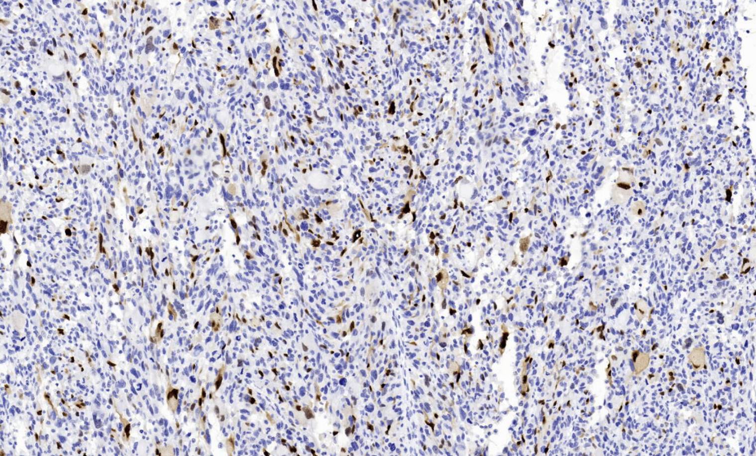 14 - Myogenin AD80490