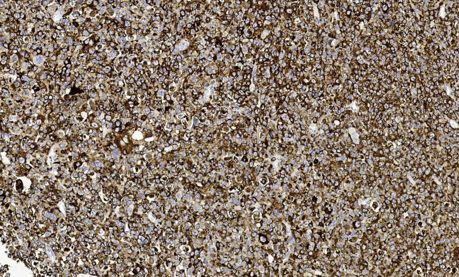 14 - Melanoma（Pan） AD80496