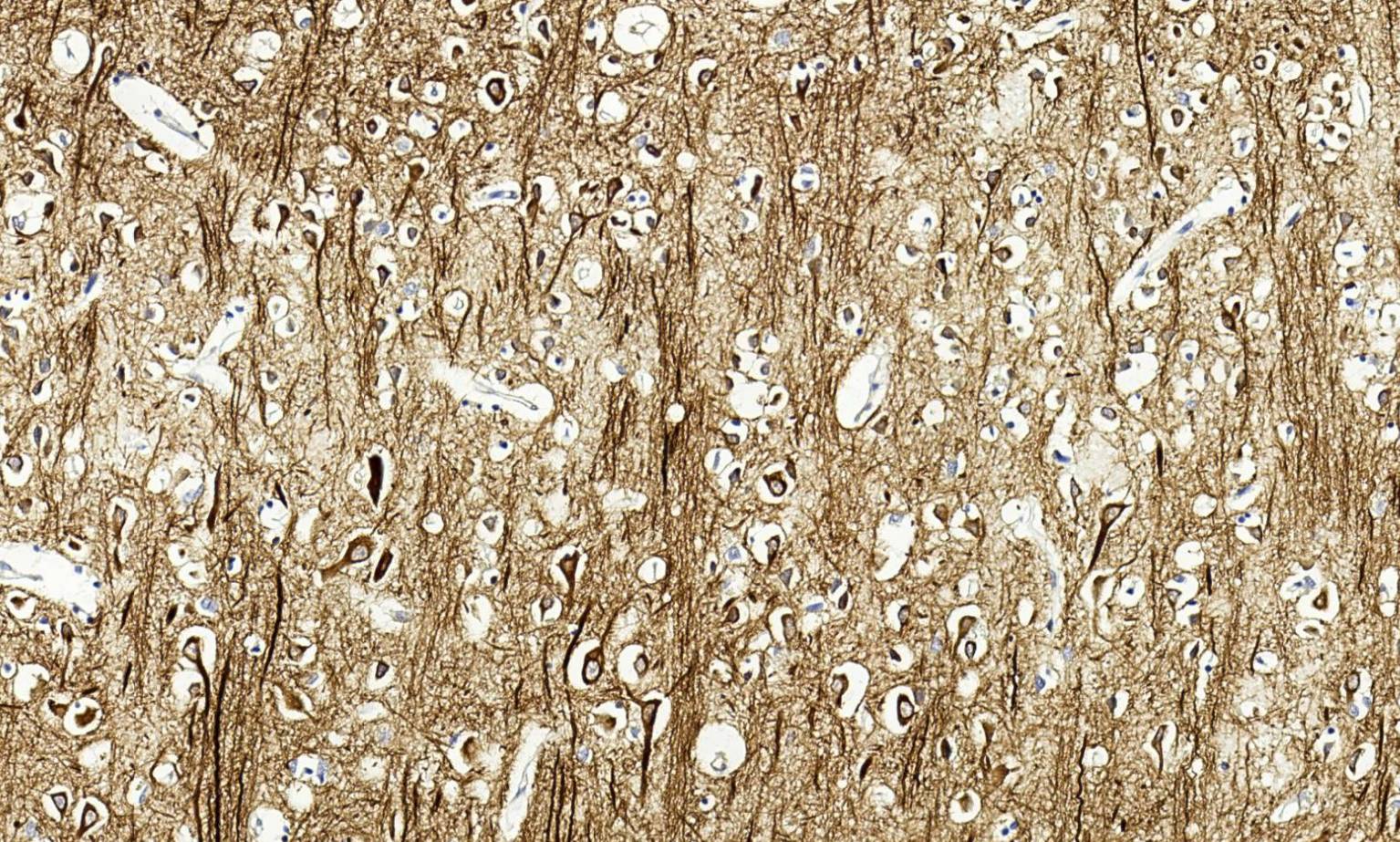 14 - MAP2 AD80502