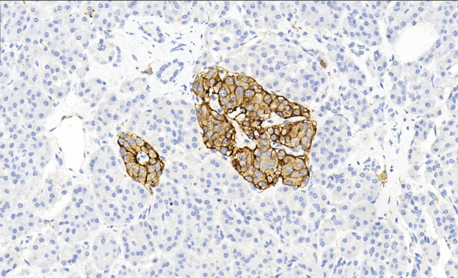 14 - SSTR 2 AD80506