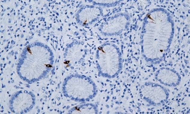 14 - Gastrin AD80507