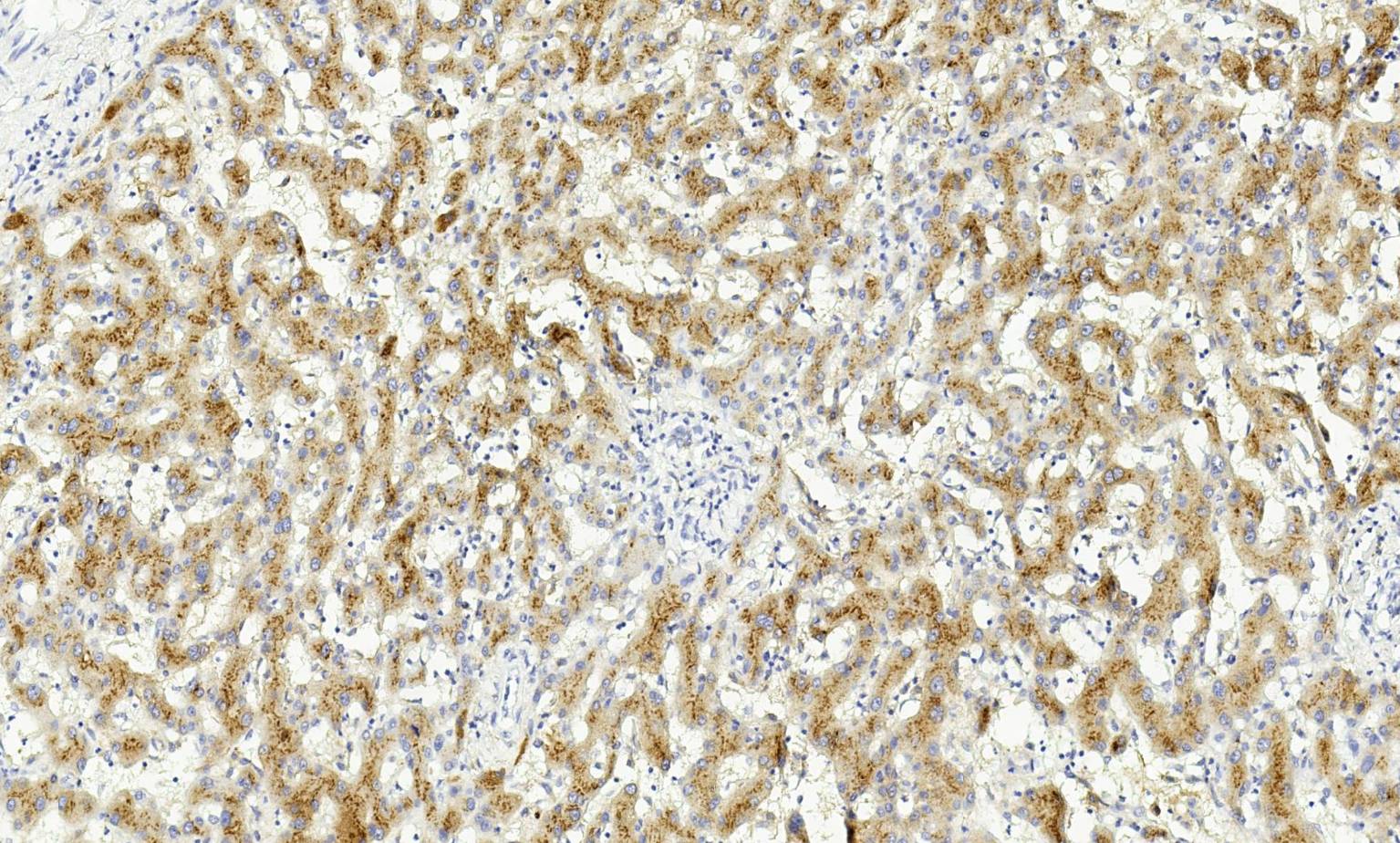 14 - Amyloid A AD80510